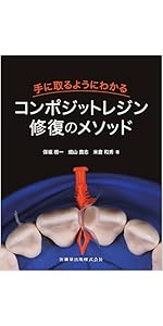 臼歯部コンポジットレジン修復: MI時代の臨床戦略 | 天川 由美子
